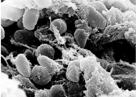 Foto bacteria ratas marrones